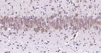 MAGE-1 Rabbit Polyclonal Antibody