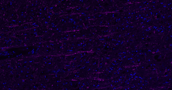MBP Rabbit Polyclonal Antibody