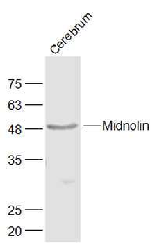 Midnolin Rabbit Polyclonal Antibody