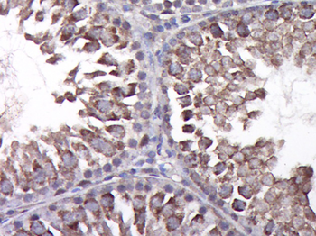 CCL4 Rabbit Polyclonal Antibody