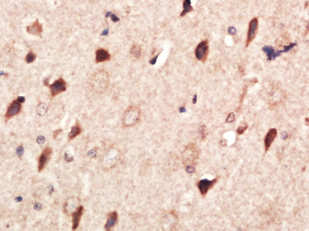 MMP2 Rabbit Polyclonal Antibody