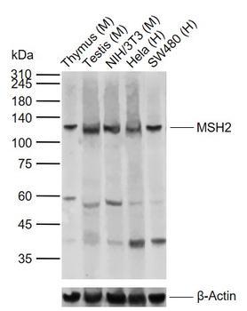 MSH2 Rabbit Polyclonal Antibody
