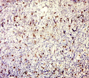 MUC1 Rabbit Polyclonal Antibody