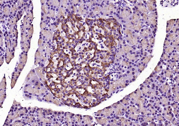 MyD88 Rabbit Polyclonal Antibody