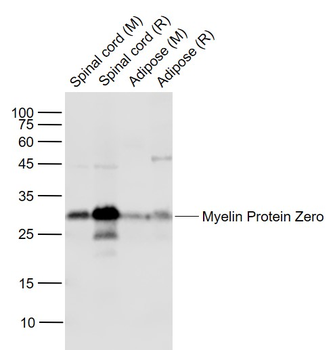 Myelin Protein Zero Rabbit Polyclonal Antibody