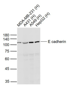 E cadherin Rabbit Polyclonal Antibody