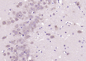 PAFAHG Rabbit Polyclonal Antibody