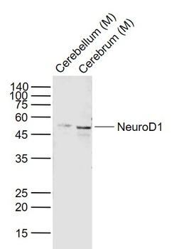 NEUROD1 Rabbit Polyclonal Antibody