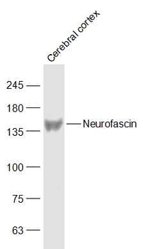 Neurofascin Rabbit Polyclonal Antibody