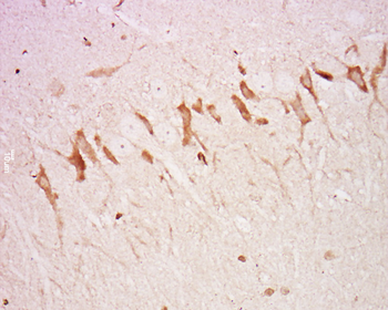 Neurofascin Rabbit Polyclonal Antibody