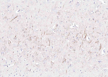 NF-H Rabbit Polyclonal Antibody