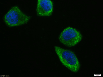 NFKB p65 Rabbit Polyclonal Antibody