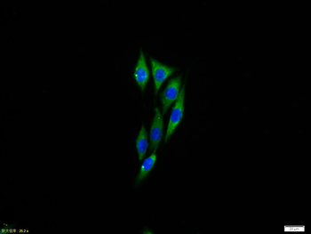 NFKB p65 Rabbit Polyclonal Antibody