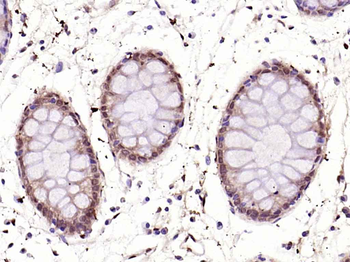NFKB p65 Rabbit Polyclonal Antibody