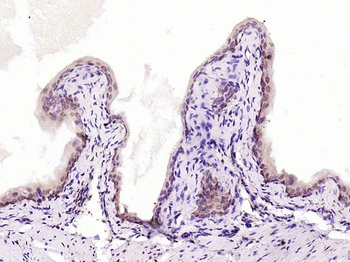 NFKB p65 Rabbit Polyclonal Antibody