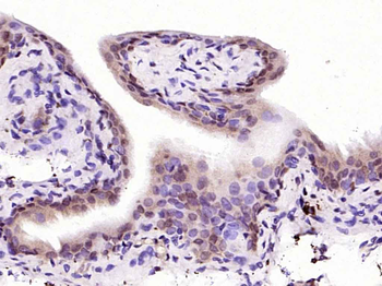 NFKB p65 Rabbit Polyclonal Antibody