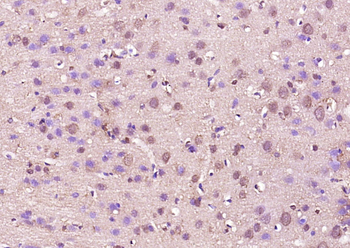 P47/Pleckstrin Rabbit Polyclonal Antibody