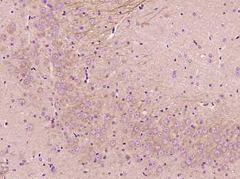 NFAT2 Rabbit Polyclonal Antibody
