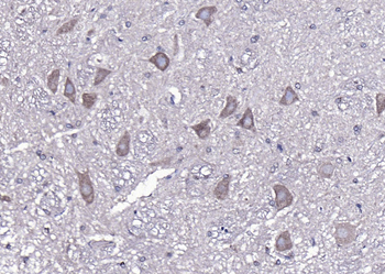 NF-M Rabbit Polyclonal Antibody