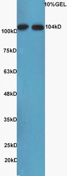 MAP3K14/NFkB Inducing Kinase Rabbit Polyclonal Antibody