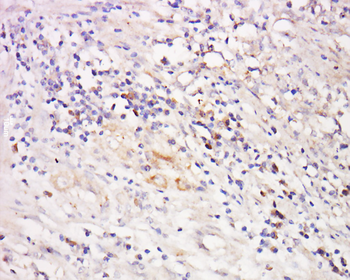 MAP3K14/NFkB Inducing Kinase Rabbit Polyclonal Antibody