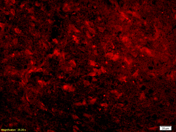 Nociceptin receptor Rabbit Polyclonal Antibody