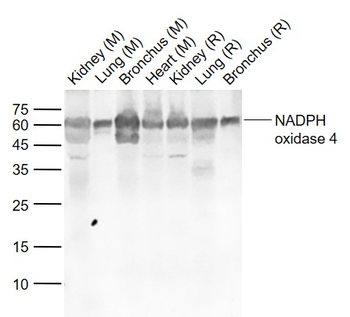 NADPH oxidase 4 Rabbit Polyclonal Antibody