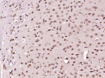 NADPH oxidase 4 Rabbit Polyclonal Antibody