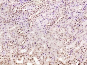 NADPH oxidase 4 Rabbit Polyclonal Antibody