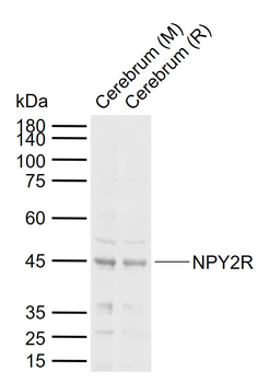 NPY2R Rabbit Polyclonal Antibody