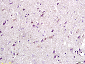 NMDAR2B Rabbit Polyclonal Antibody