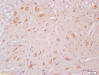 NMDAR2B Rabbit Polyclonal Antibody