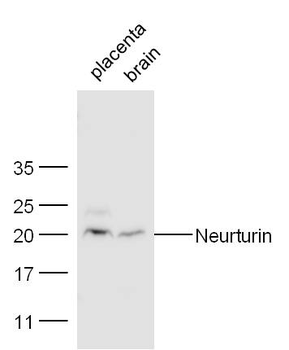 Neurturin Rabbit Polyclonal Antibody