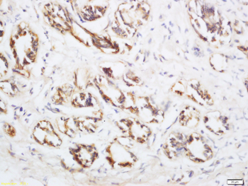 Neurturin Rabbit Polyclonal Antibody