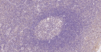Nurr1 Rabbit Polyclonal Antibody