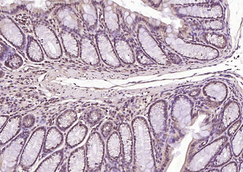 OCT-1 Rabbit Polyclonal Antibody
