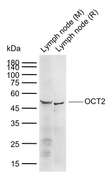 OCT2 Rabbit Polyclonal Antibody