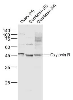Oxytocin R Rabbit Polyclonal Antibody