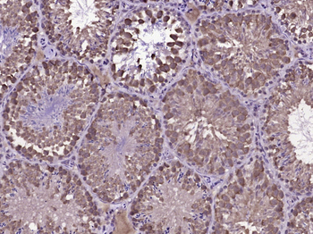 RBBP6 Rabbit Polyclonal Antibody