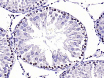 CDKN1A/p21 Rabbit Polyclonal Antibody
