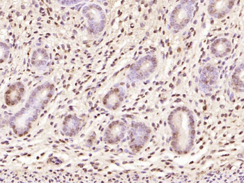 CDKN1A/p21 Rabbit Polyclonal Antibody