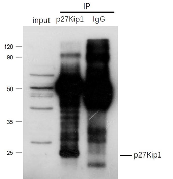 CDKN1B/p27 KIP 1 Rabbit Polyclonal Antibody