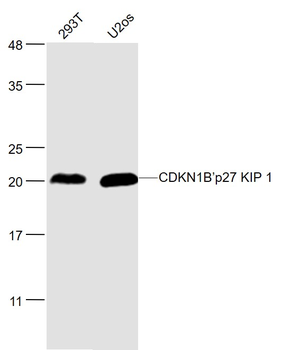 CDKN1B/p27 KIP 1 Rabbit Polyclonal Antibody