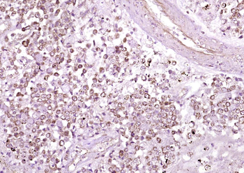 GDN Rabbit Polyclonal Antibody