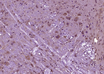 GDN Rabbit Polyclonal Antibody