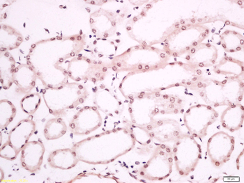 Phospho-P53 (Ser392) Rabbit Polyclonal Antibody
