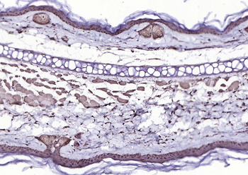 P73 Rabbit Polyclonal Antibody