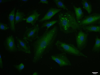 PAI1 Rabbit Polyclonal Antibody