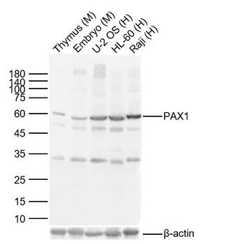 PAX1 Rabbit Polyclonal Antibody
