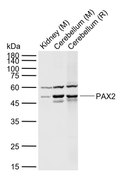 PAX2 Rabbit Polyclonal Antibody